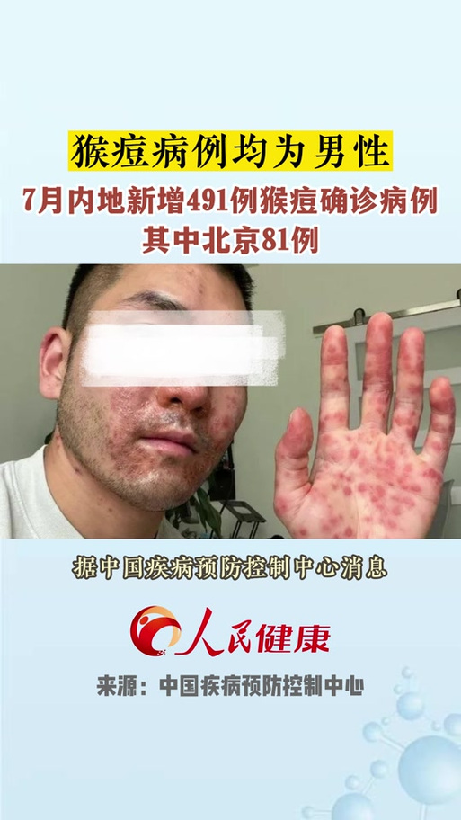 全球疫情最新消息/全球疫情最新消息什么时候能结束-第7张图片 全球疫情最新消息/全球疫情最新消息什么时候能结束-第7张图片